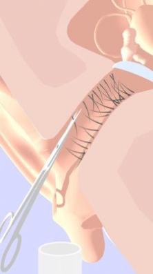 挖耳朵模拟器 挖耳朵模拟器