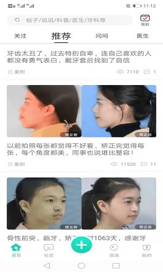 牙套之家 牙套之家