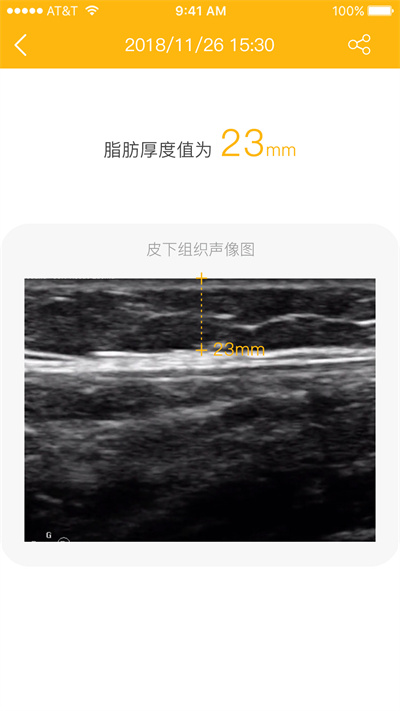 脂肪厚度仪app 脂肪厚度仪app